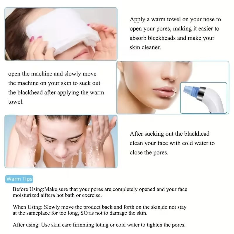 Convenient Home Electric Blackhead Remover